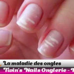 maladie-des-ongles