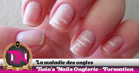 maladie-des-ongles