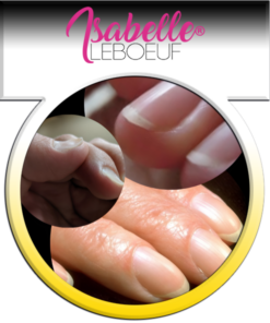 FORMATION ONLINE CORRECTION DES ONGLES BOMBÉS ET DES ONGLES CUILLÈRES