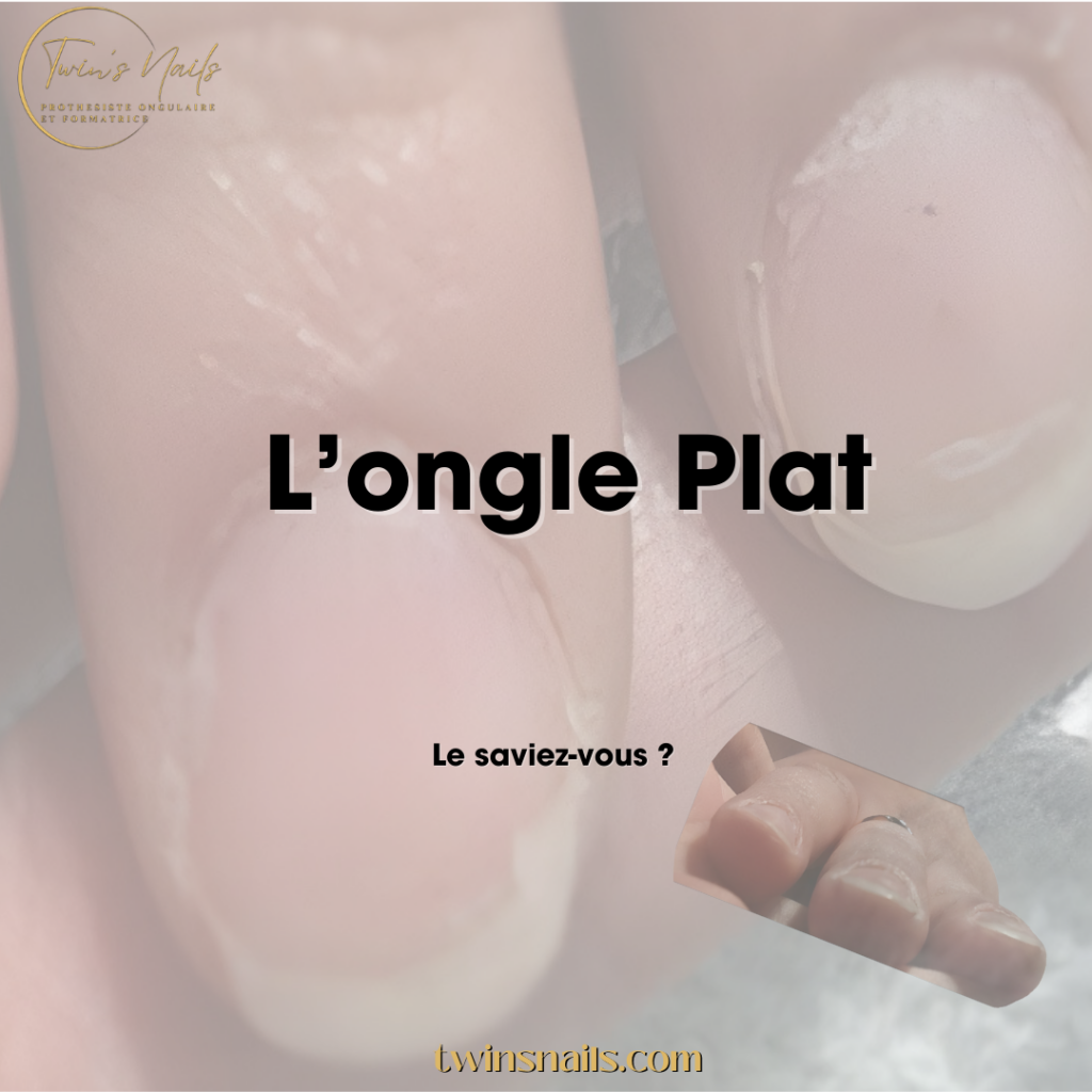 L'ONGLE PLAT