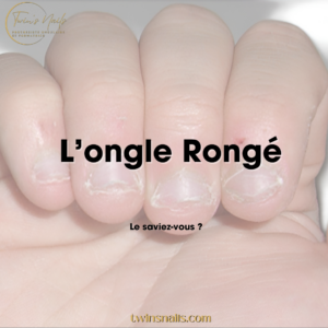 L'ONGLE RONGÉ