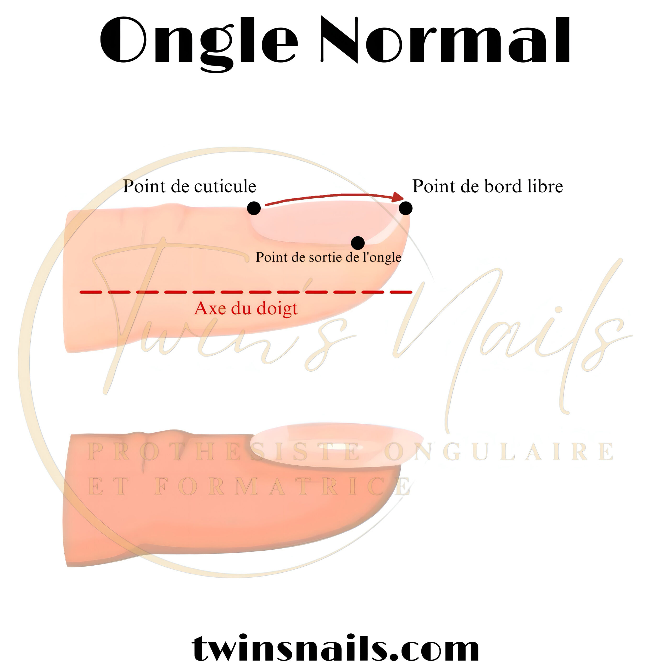 L'ONGLE NORMAL