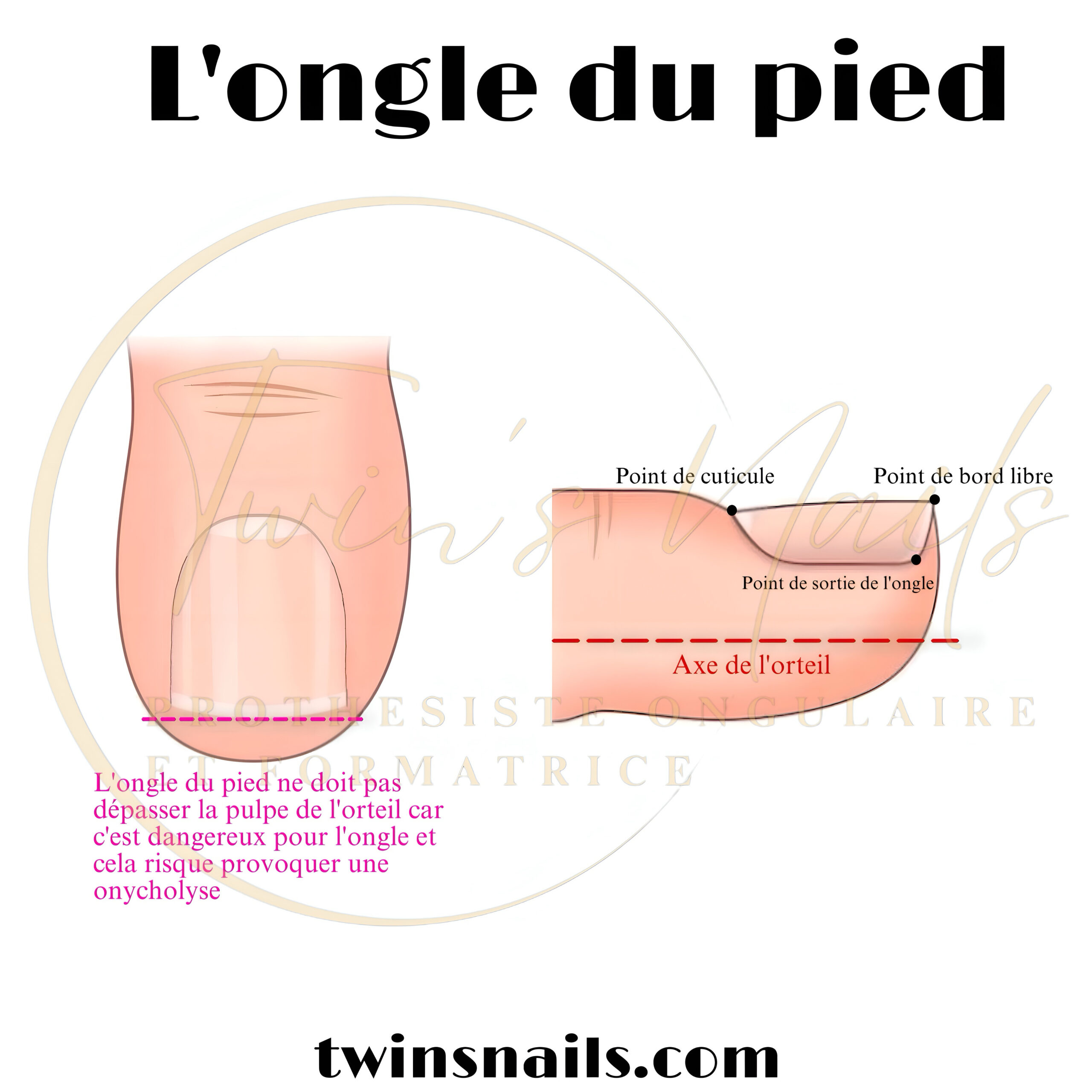 L'ONGLE DU PIED