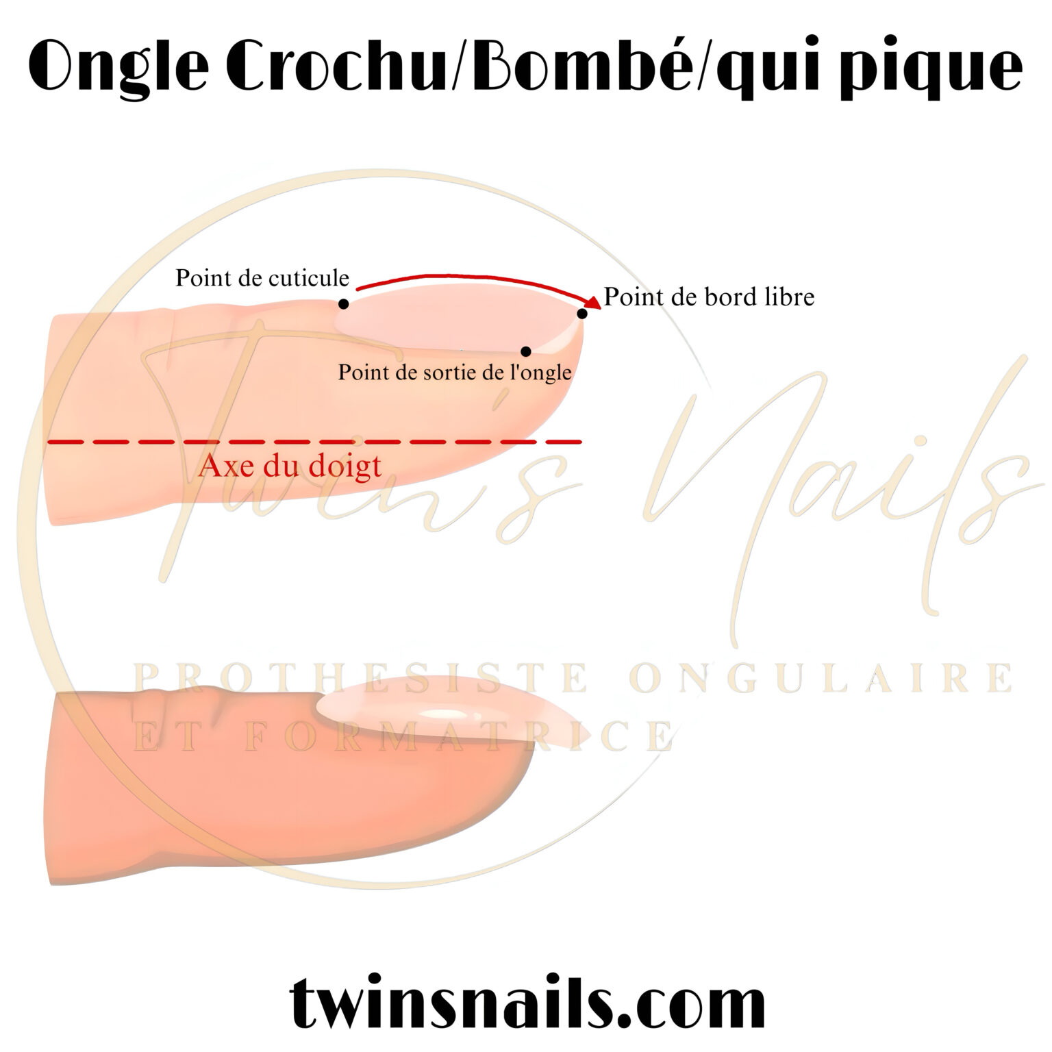 L'ONGLE CONVEXE