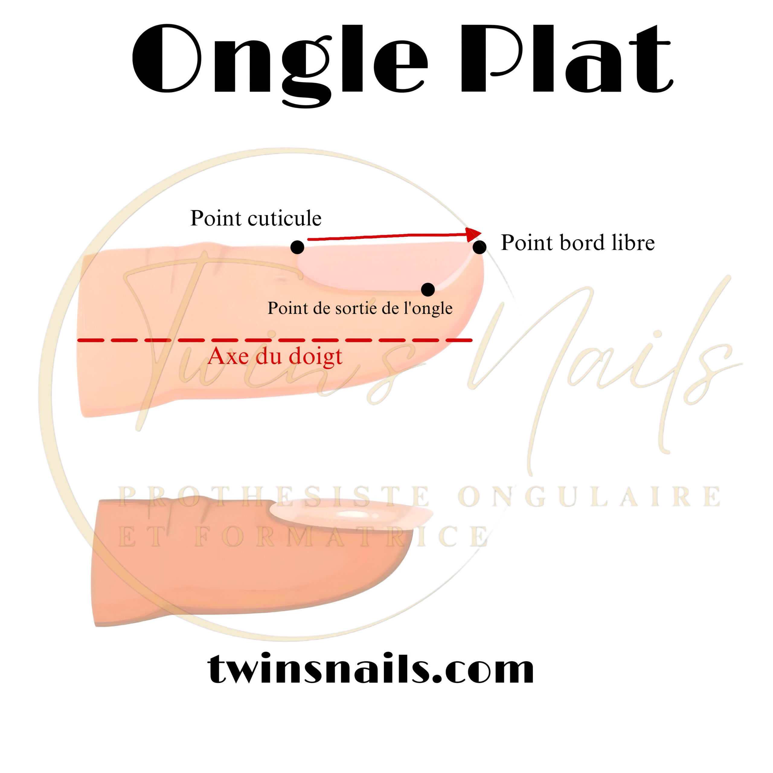 L`ONGLE PLAT