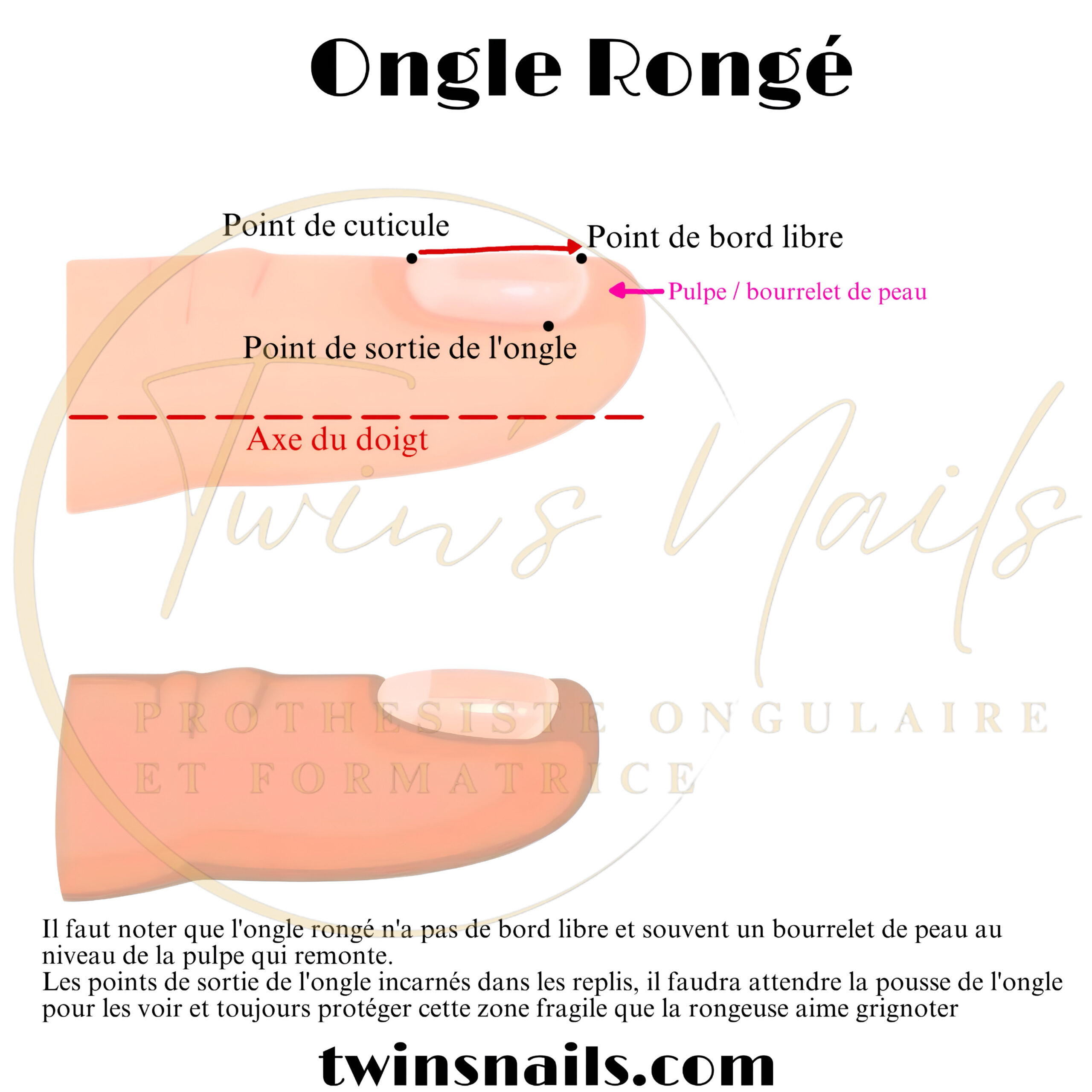 L'ONGLE RONGÉ