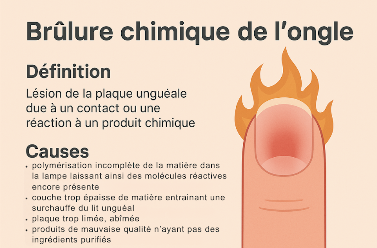 BRULURE CHIMIQUE DE L'ONGLE