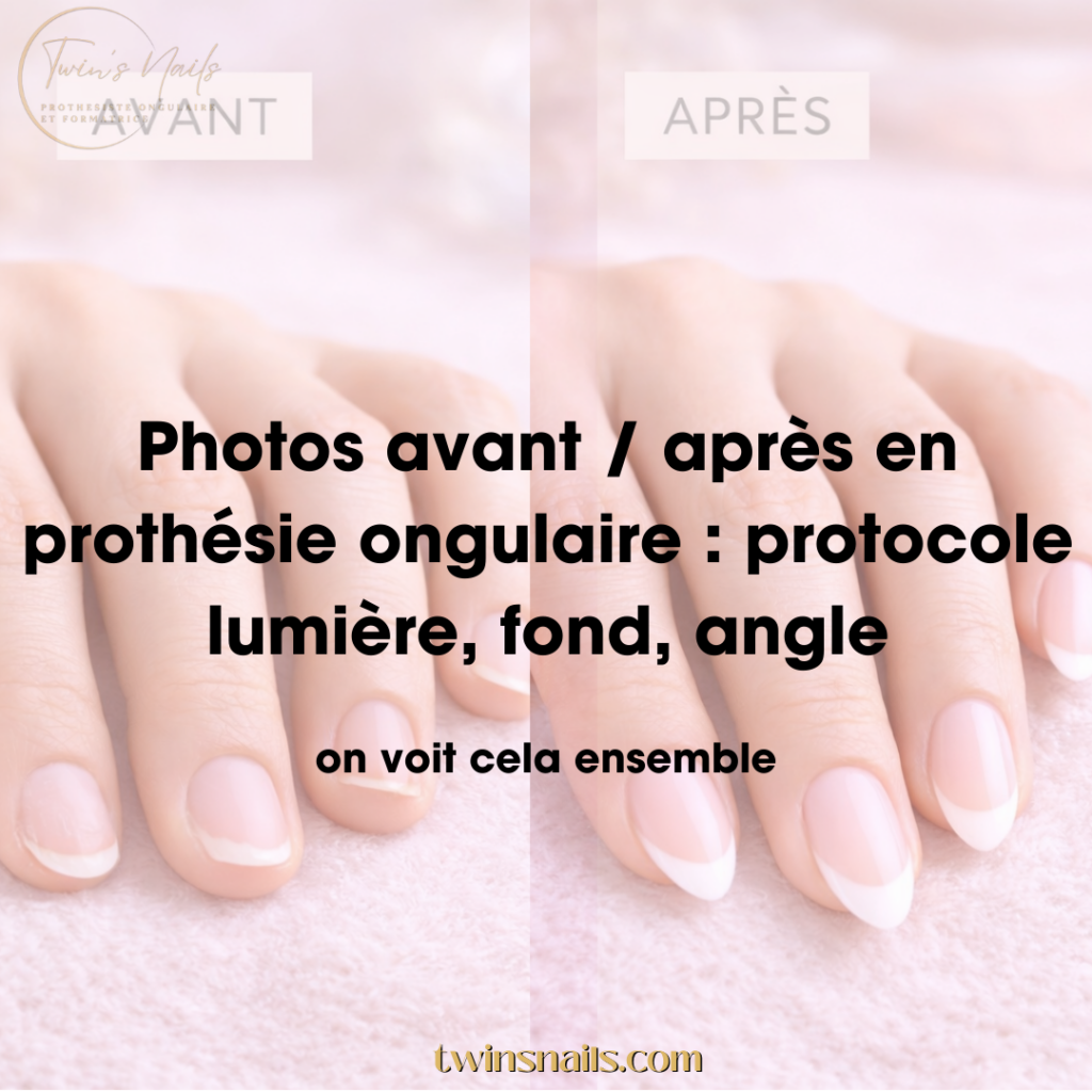 PHOTOS AVANT/APRÈS EN PROTHÉSIE ONGULAIRE : PROTOCOLE, LUMIÈRE, FOND, ANGLE